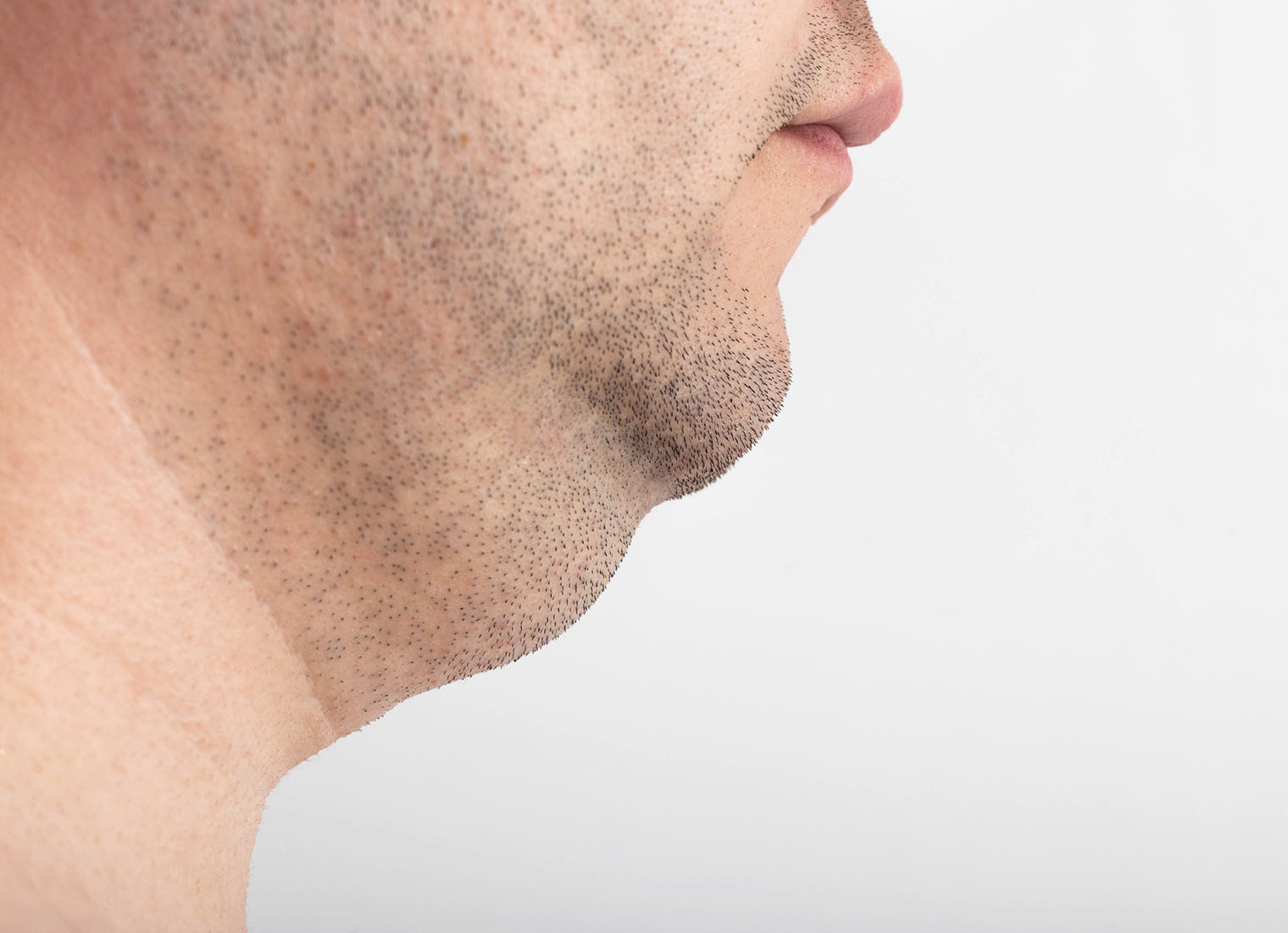Confident client considering fat dissolving injections