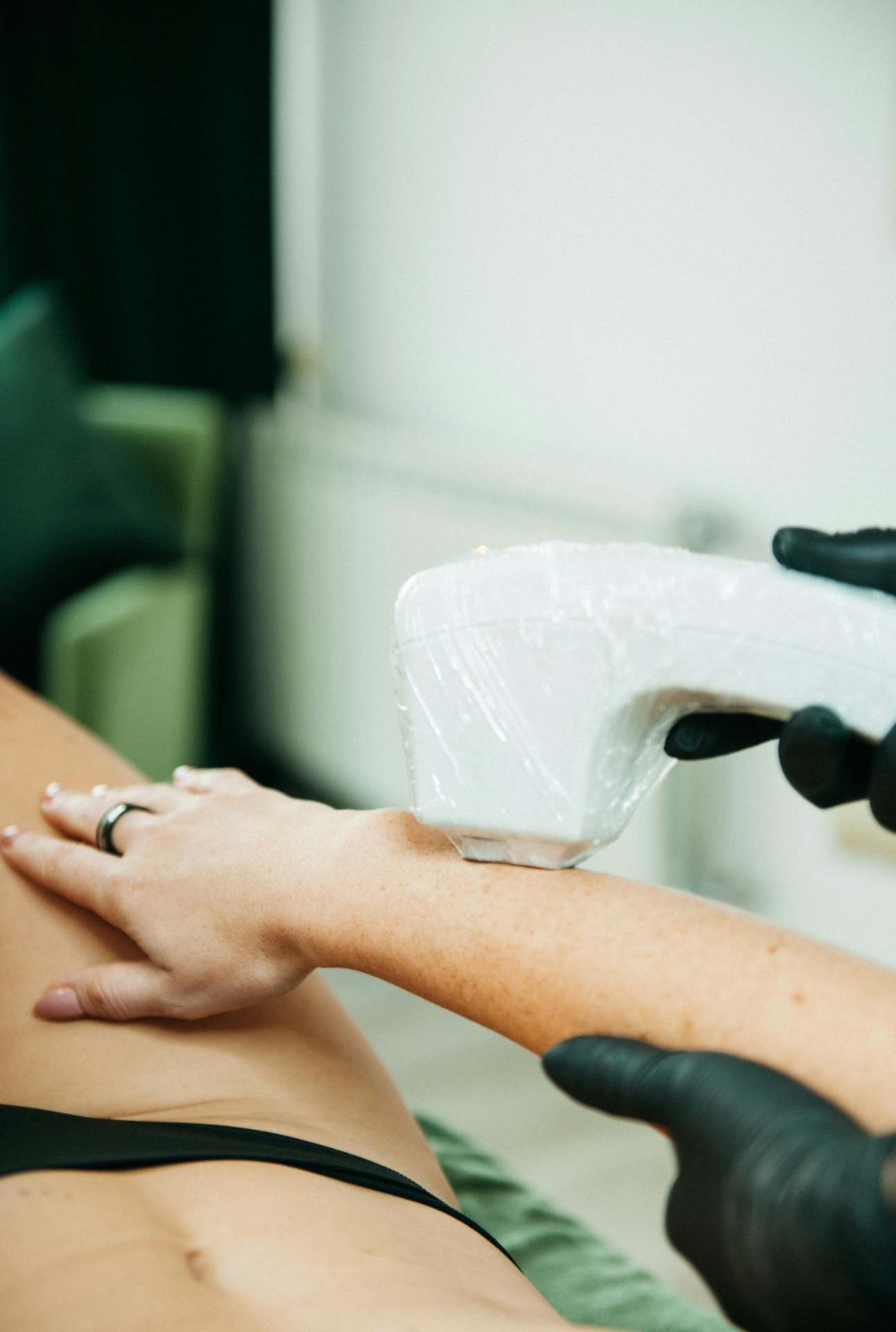 A qualified Vale Laser Aesthetics clinician carefully guiding the medical-grade laser handpiece across a client's skin during a treatment session in our Cardiff clinic