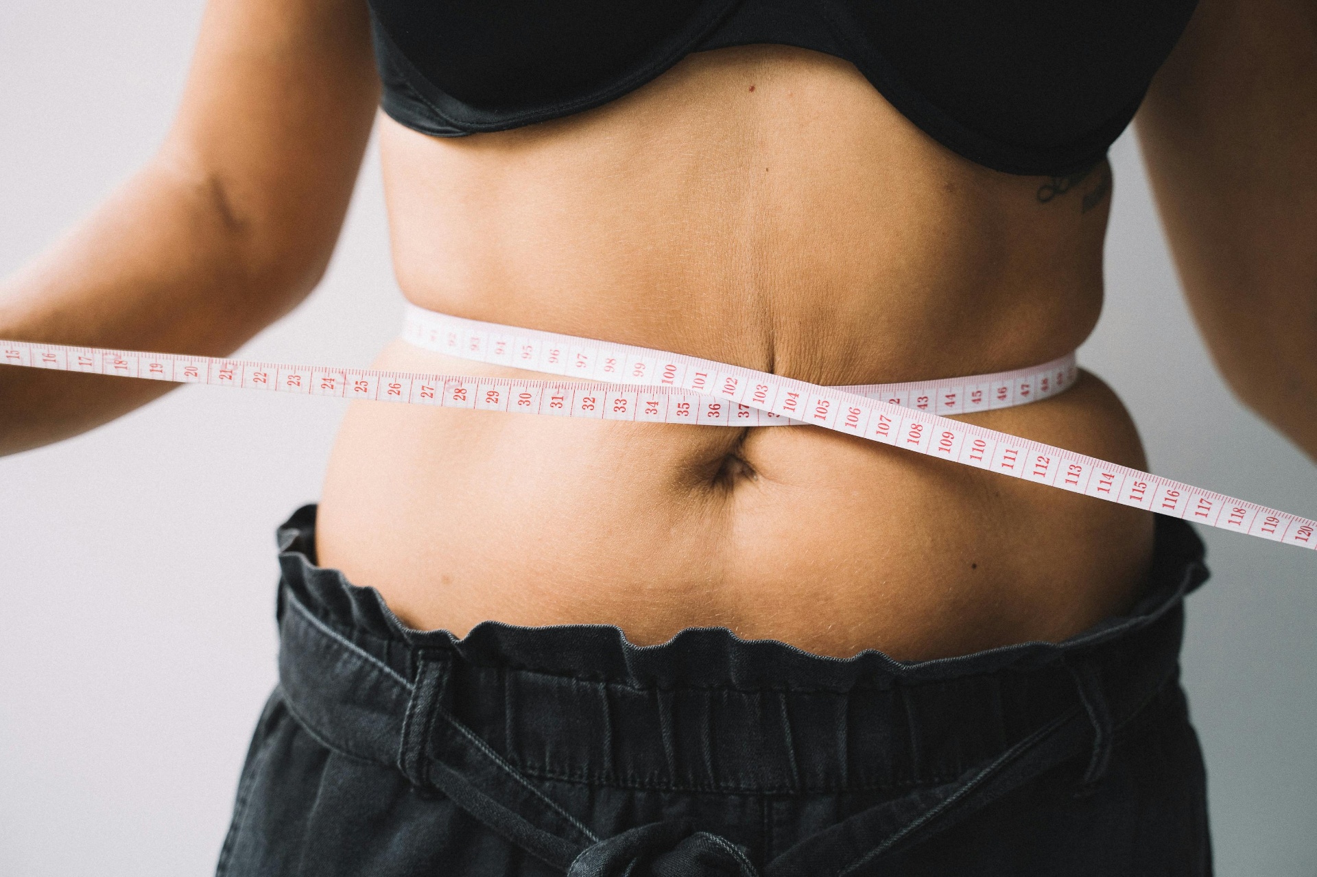 Fat dissolving injections at Vale Laser Aesthetics Cardiff Gate