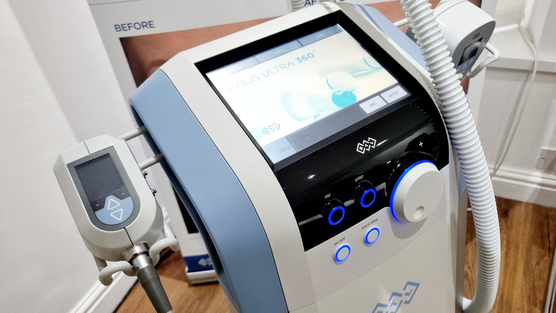 Close-up of medical grade laser equipment at Vale Laser Aesthetics, showing the clinical device controls used to tailor treatment settings