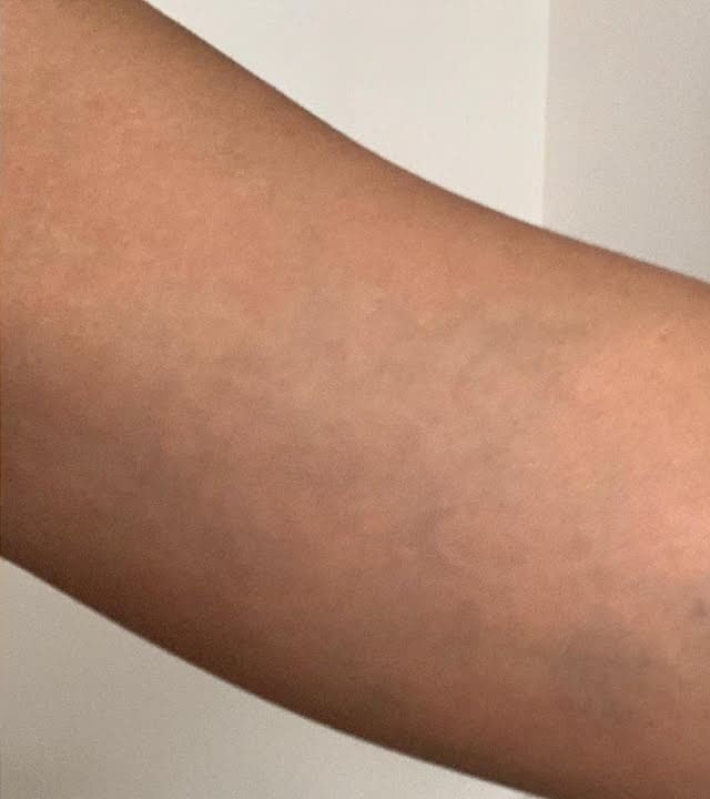 After - Black / grey ink removal