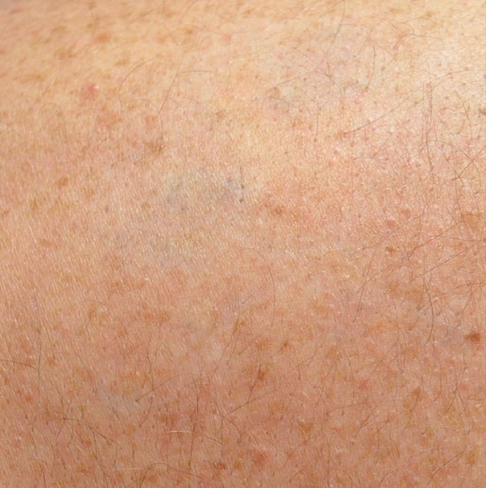 After - Black / red ink removal