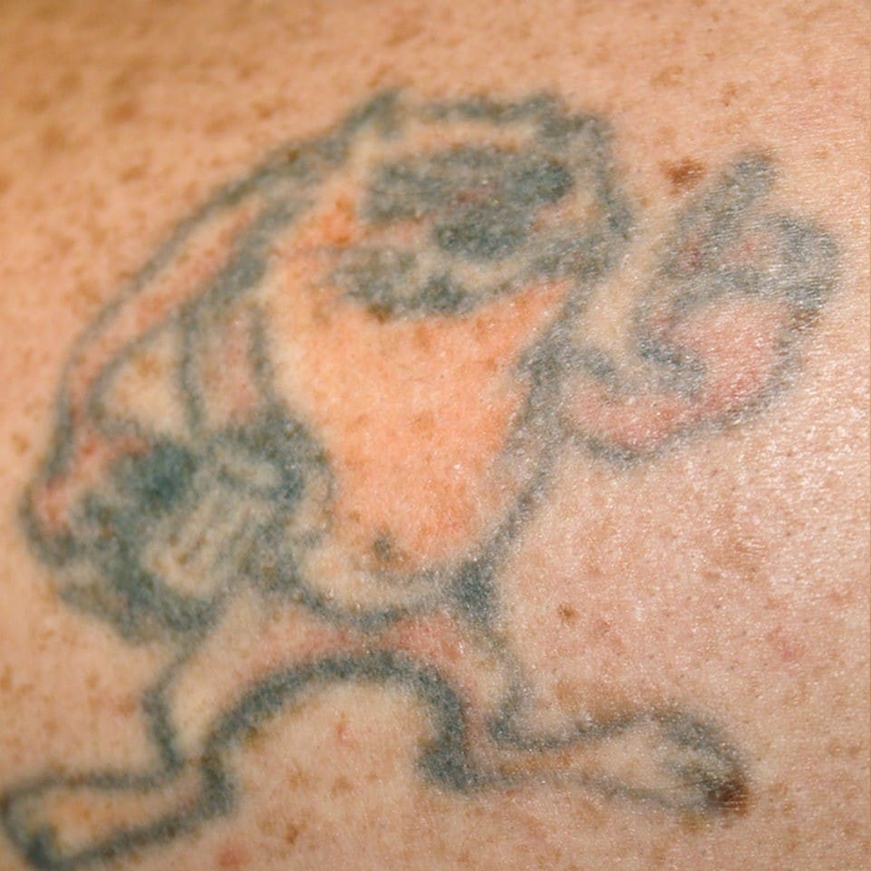Before - Black / red ink removal