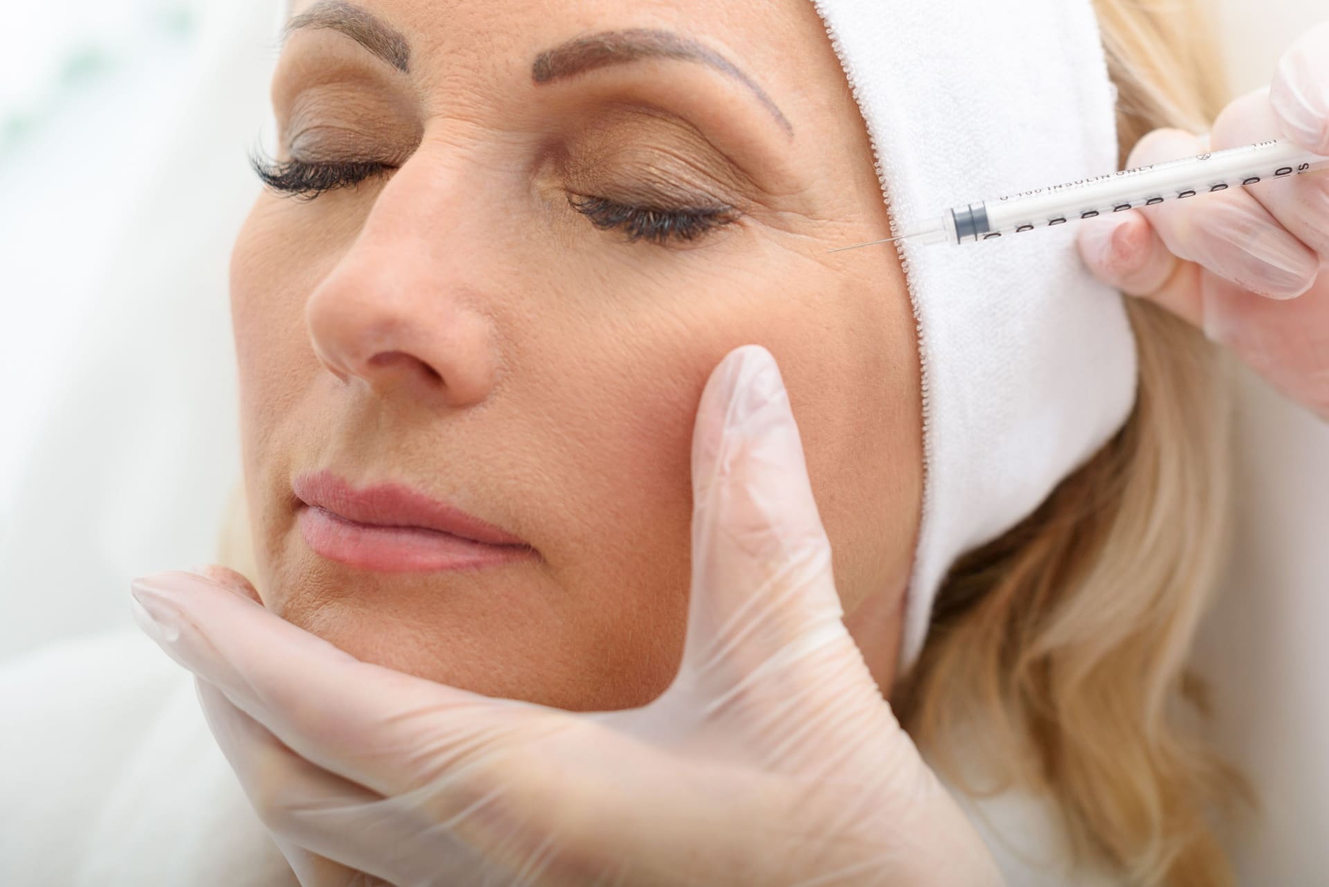 Dermal filler treatment