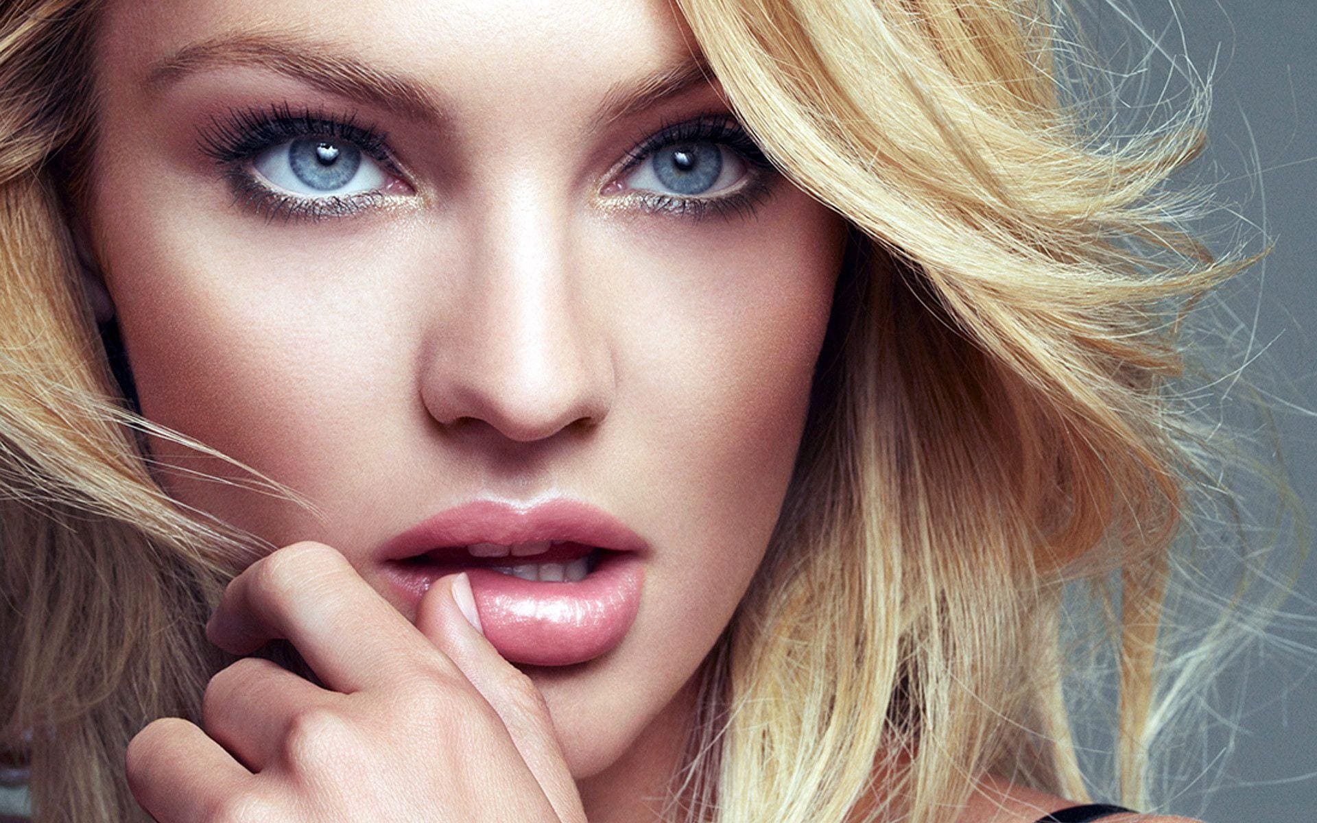 Lip augmentation treatment at Vale Laser