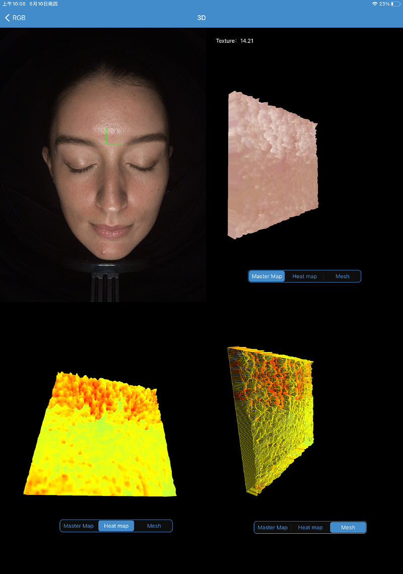 MEICET 3D Skin Analyzer