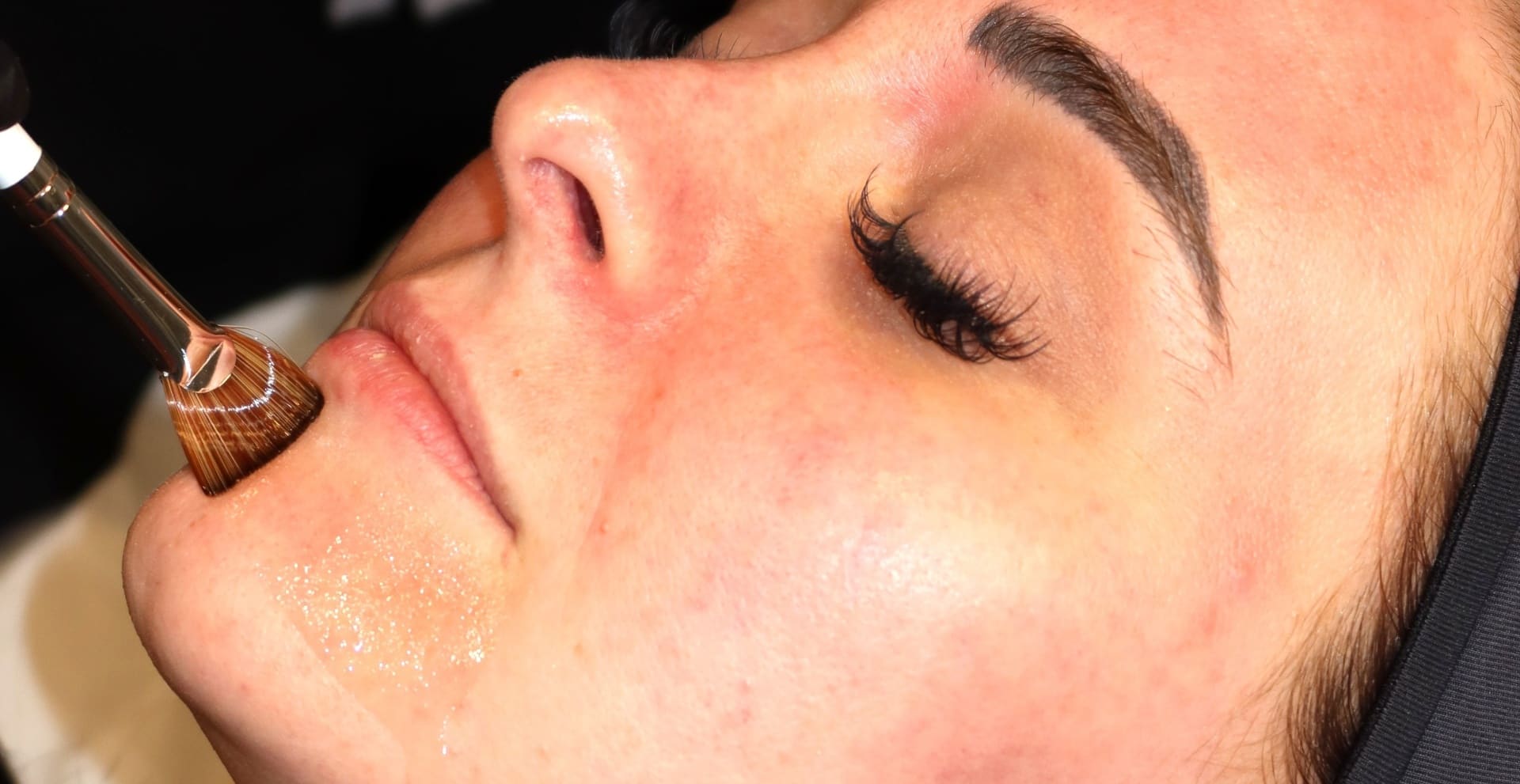 Alumier MD Chemical Peels
